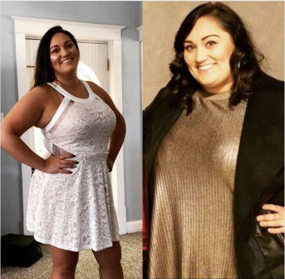 Fresno Weight Loss