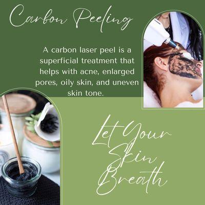 Carbon Laser Peeling