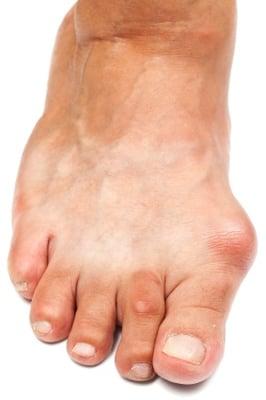 Podiatrist, Fungal Nail Treatment, Ingrown Toenails, Heel Paim, Orthotics