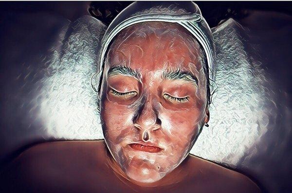 Acne facial