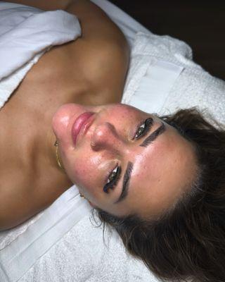 Signature facial with chemical peel