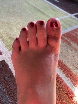 It's Saturday, this is a 5 day old pedicure.