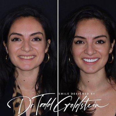 Before & After Results from The Smile Aesthetic | Red Bank, NJ