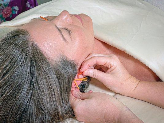 Asheville Holistic Acupuncture