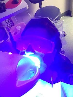 Zoom whitening