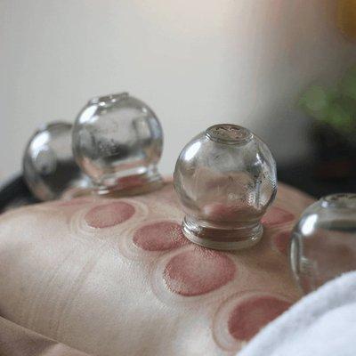 Cupping therapy