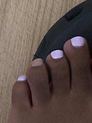 Toes