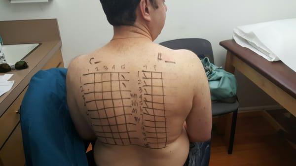 Allergy test..p.s. yes I need to lose weight.