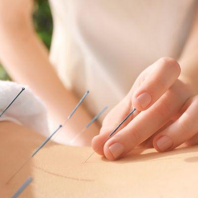 ACA Acupuncture & Wellness - Herald Square