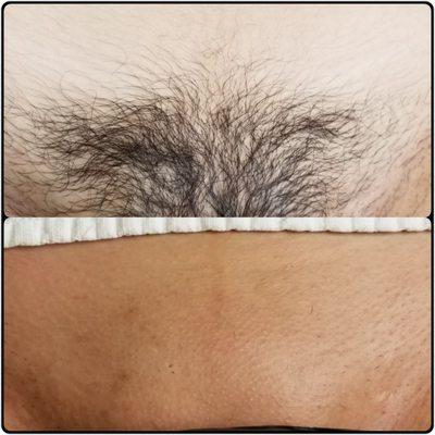 Brazilian Wax