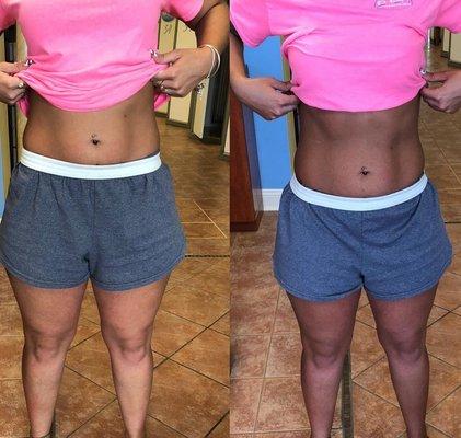 Before and after a sunless spray tan