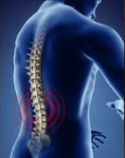 Treating Back Pain