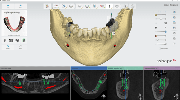 Fidelity Dental Labortory