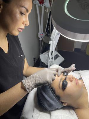 Dermaplaning Procedure