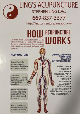 ling's Acupuncture