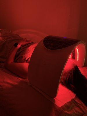 Infra Red Light Treatment post Microneedling