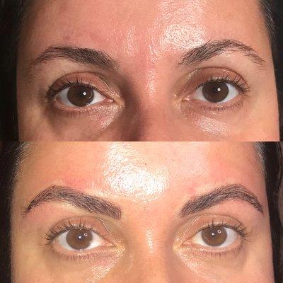 Beautiful transformation! Gave her a more uplifted, youthful look with natural looking, eye opening brows.