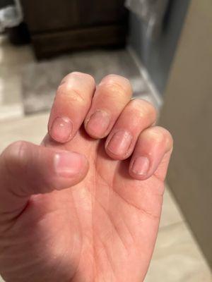 This was my nails after a manicure!