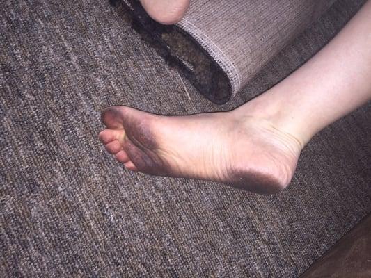 After we paid extra for the carpets to be deep cleaned this is what our feet looked like walking on it.